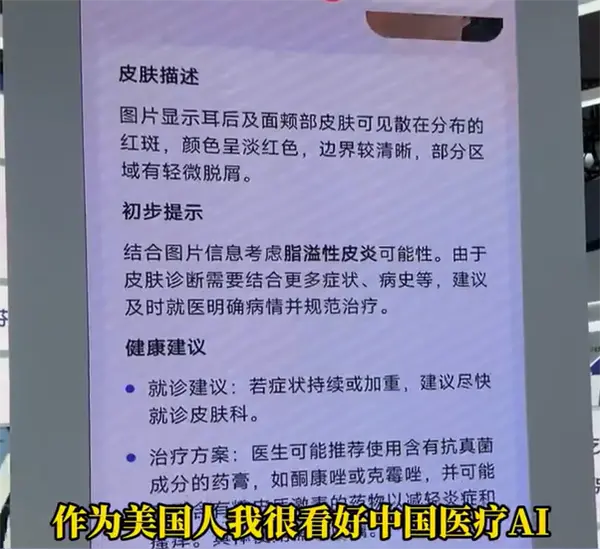 博主坦言美國看病太貴太麻煩：想把中國的AI醫生帶回去